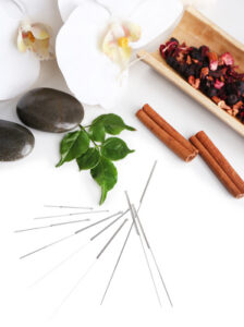 needles for acupuncture- Sophia Natural Health