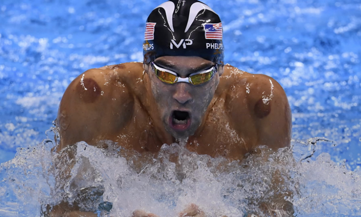 What Is Cupping and Why Is it Leaving Some Olympians With Spots?