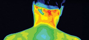 Thermography-Sophia Natural Health Center