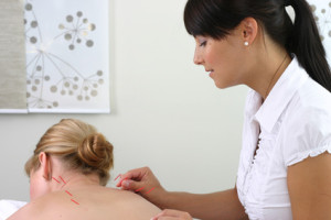 5 Things You Didn’t Know About Acupuncture