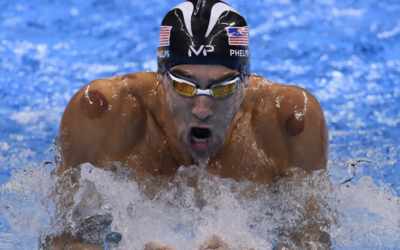 What Is Cupping and Why Is it Leaving Some Olympians With Spots?