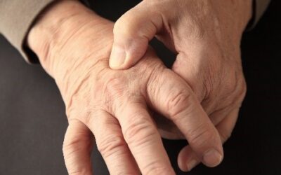 Arthritis – Success