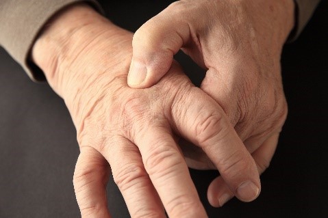 Arthritis and Chronic Pain