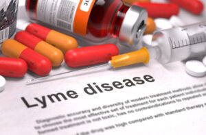 Diagnosis - Lyme Disease