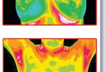 October Is Breast Cancer Awareness Month – Why Haven’t You Gotten Your Thermogram Yet?