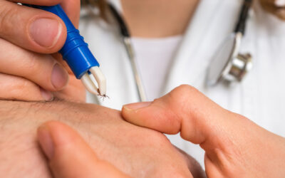 Tick season is here: what to do?