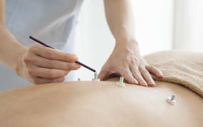 What is Moxibustion & What Does It Treat?