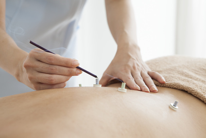 What is Moxibustion & What Does It Treat?