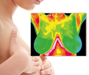 Thermo Imaging