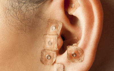 Acupuncture Happy Hour